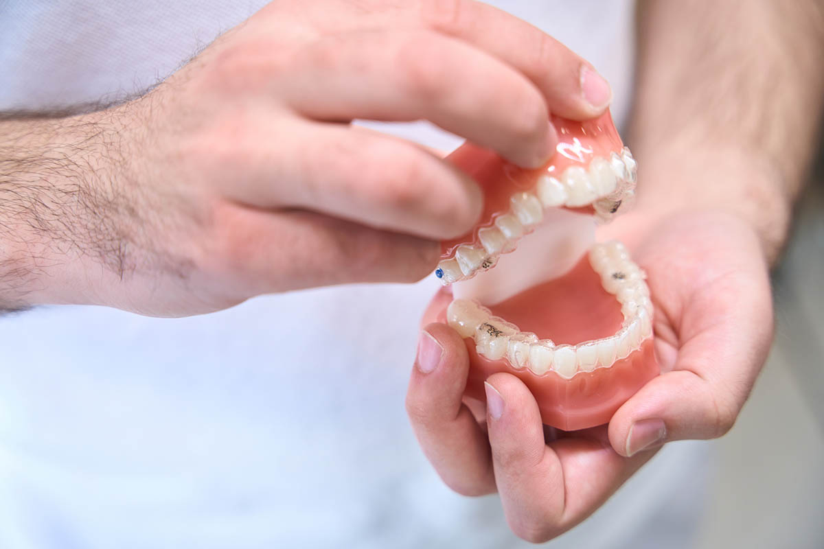 Doctor demonstrates sample of dental aligners on model of jaws